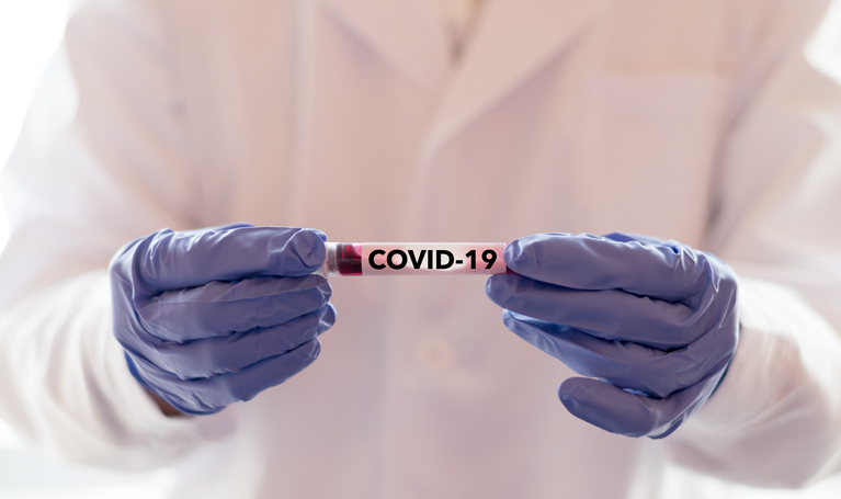 Reportan el 87 casos de coronavirus en Querétaro