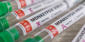 Llega nueva cuarentena: Bélgica se encierra por viruela del mono